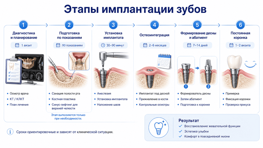 Этапы имплантации зубов от диагностики до установки коронки
